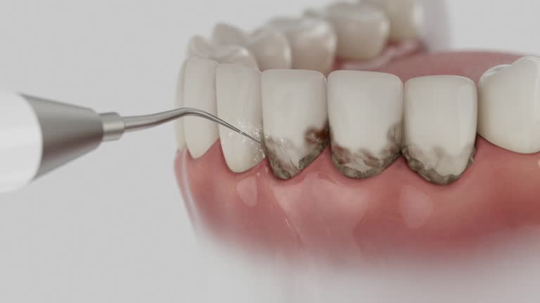 Reliable Dental contractor in Nappanee, IN by Dentist Open Now